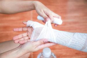 Birmingham Burn Injury Lawyer